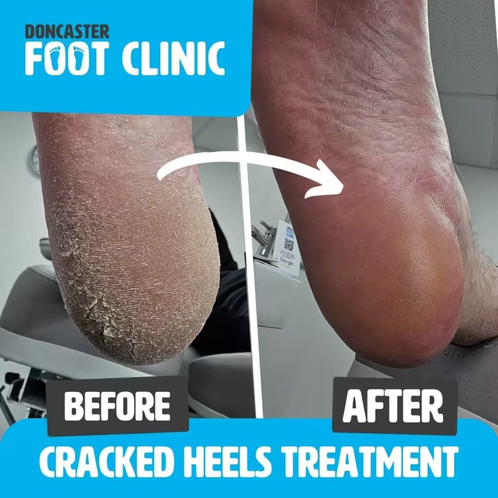 Copy of Copy of Doncaster Foot Clinic Square Templates 15 converted