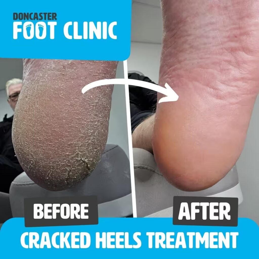 Copy of Copy of Doncaster Foot Clinic Square Templates 16 converted